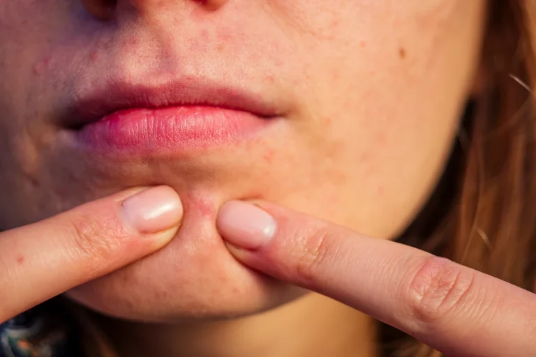 Une femme qui touche à un bouton